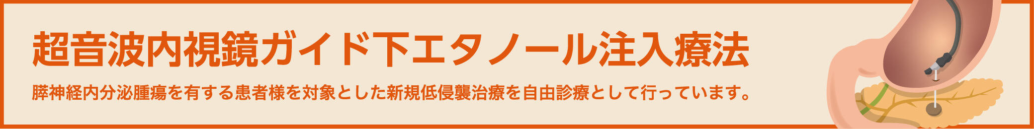 超音波内視鏡ガイド下エタノール注入療法